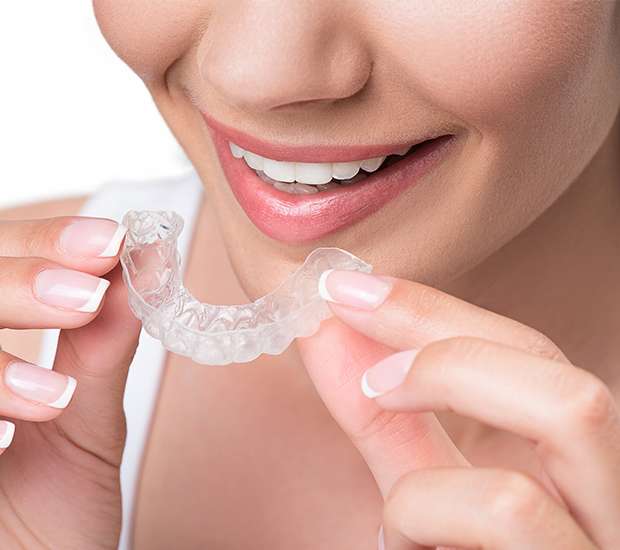 Clear Aligners