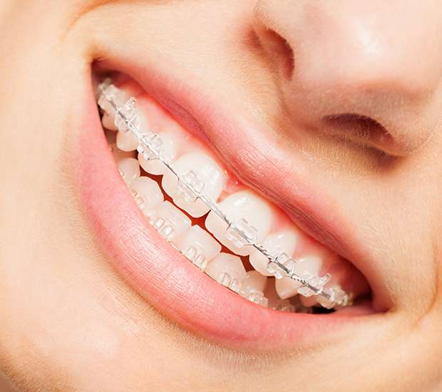 Kirkland Invisible Orthodontics