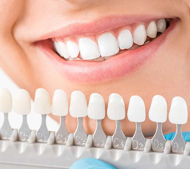 Kirkland Cosmetic Dentist
