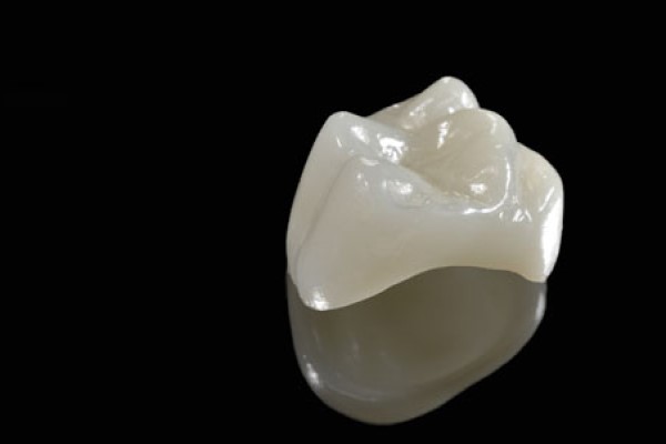 Dental Crown Kirkland, WA