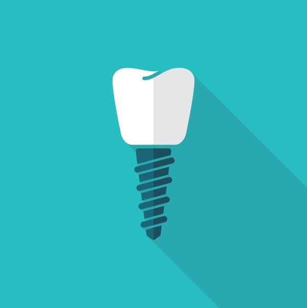 dental implants Kirkland, WA