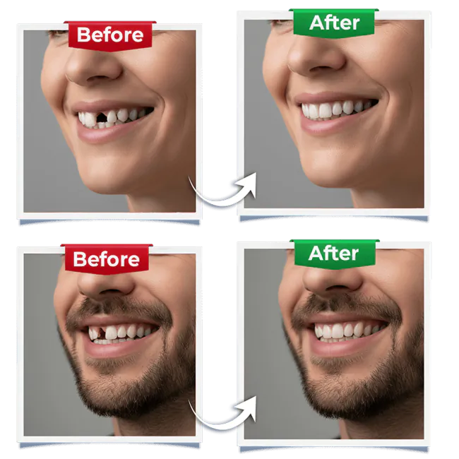 Implant Dentistry Ad