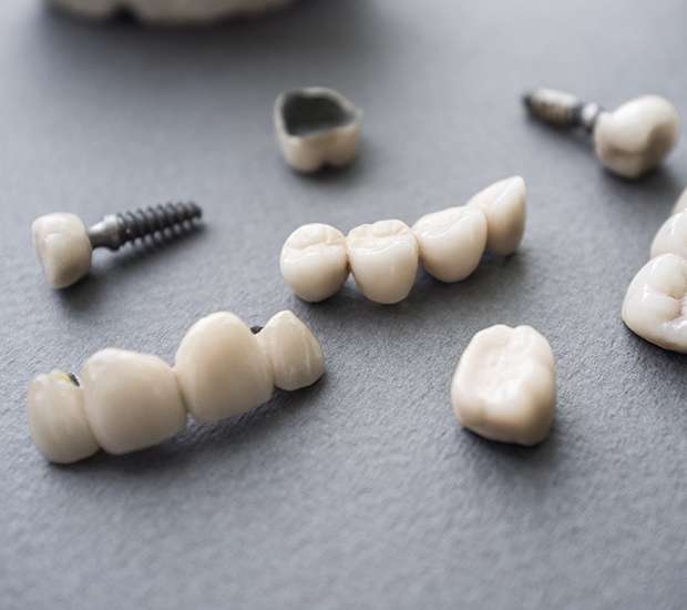 Kirkland The Difference Between Dental Implants and Mini Dental Implants