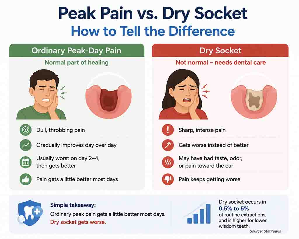 normal peak pain vs. dry socket vs. infection