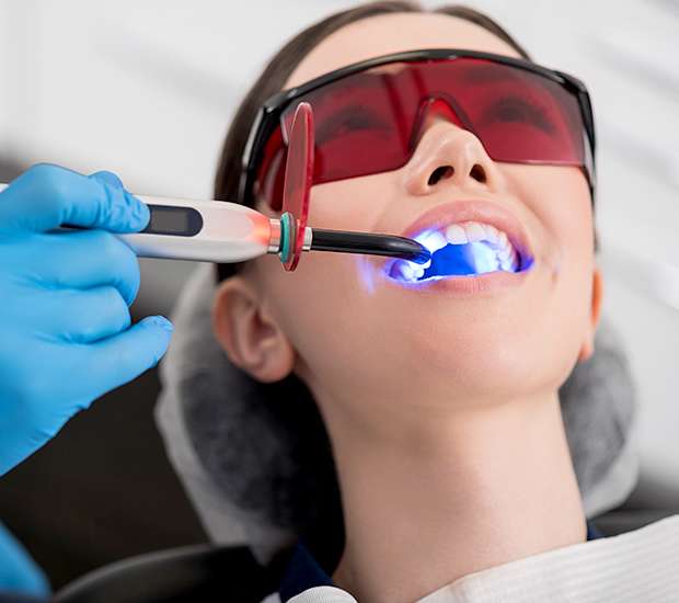 Kirkland Professional Teeth Whitening
