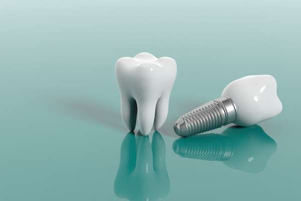 Multiple Teeth Replacement Options: One Implant for Two Teeth from Kirkland Dental Excellence in Kirkland, WA